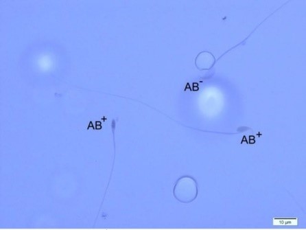 a) Anilin Blue ile sperm DNA Hasarı değerlendirilmesi