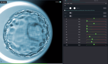 Yapay Zekâ (Artificial intelligence =AI) IVF Süreçlerini Nasıl Değiştiriyor?