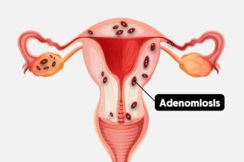 Endometriozis, Adenomyozis ve Tüp Bebek Tedavisinde Yumurta (Oosit) Kalitesi Üzerine Etkileri