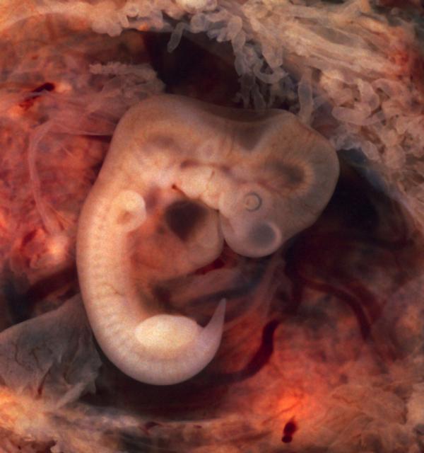 Dondurulmuş - Çözülmüş Embriyo Transferi için Naturel Siklusta Endometrial (Rahim İçi) Hazırlık