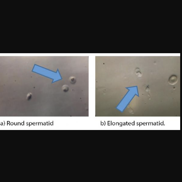 Round Spermatid Enjeksiyonu (ROSI)