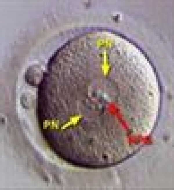 IVF (Tüp Bebek) Laboratuvarında yapılan işlemler / Kasım 2006 2. konu