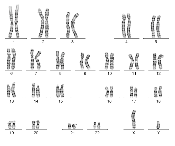 Kromozomları Normal (Euploid) Embriyo Transferlerinde Canlı Doğuma Ulaşma Oranınını Etkileyen Faktörler