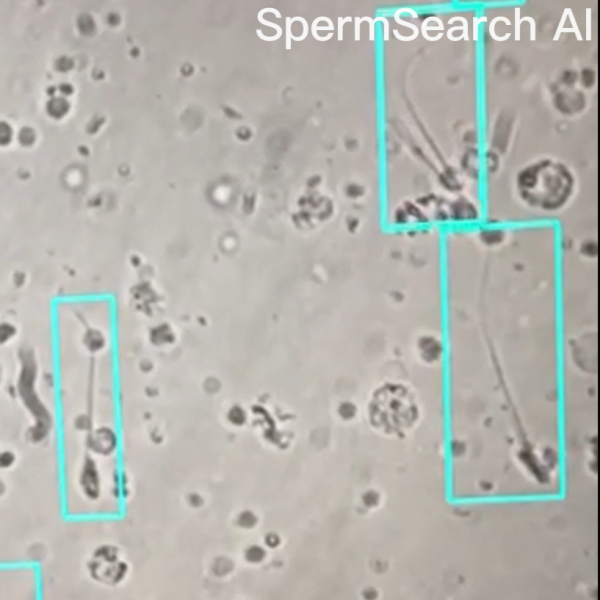 IVF Laboratuvarında Yapay Zeka Destekli Sperm Taraması ile Yeni Bir Dönem